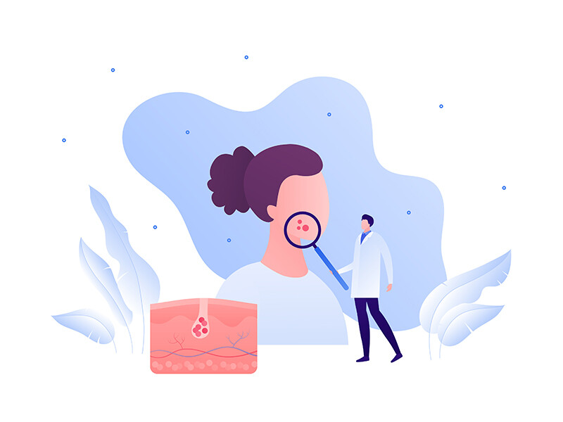 Illustration d'une personne avec de l'acné